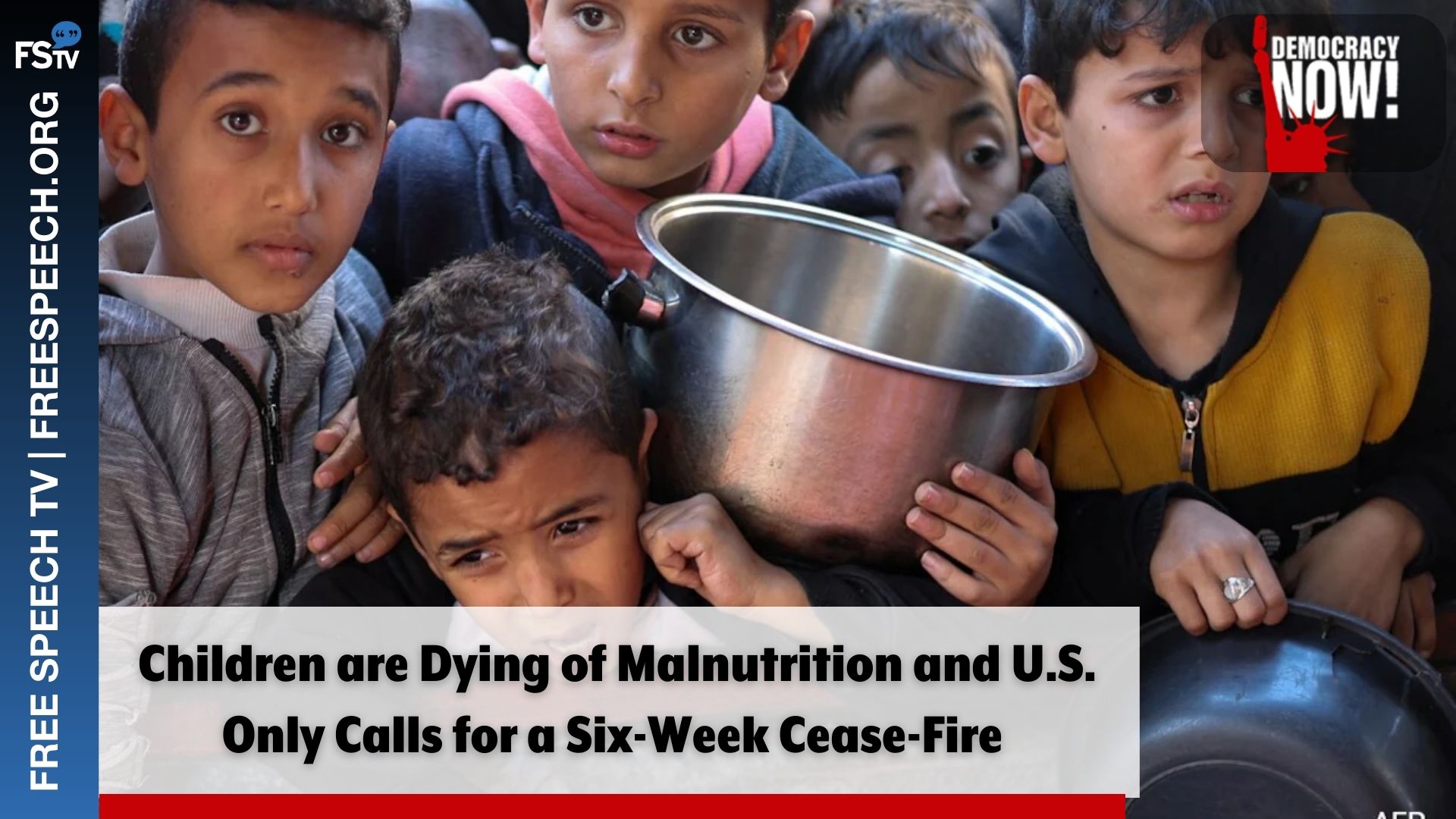 Democracy Now! | Children in are Dying of Malnutrition and U.S. Only Calls for a Six-Week Cease-Fire